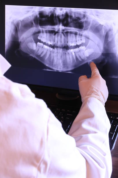 Best Knocked-Out Tooth (Avulsed Tooth) Treatment in Hales Corners, WI